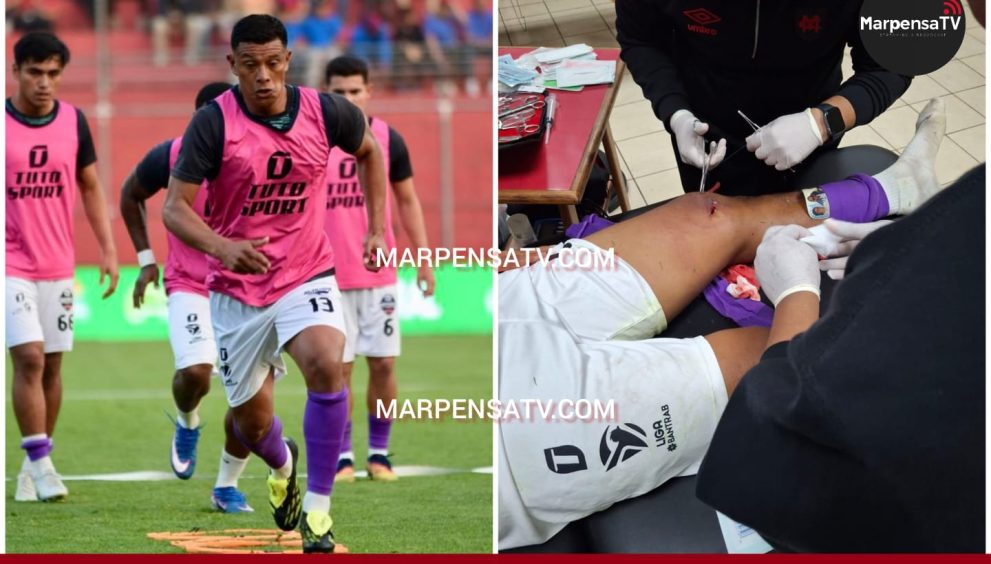 ¡Fuerza, Chamagua! Castrillo sufre fuerte golpe en El Trébol